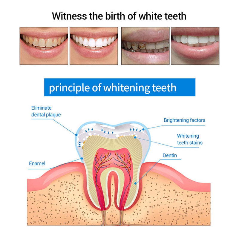 Teeth Whitening Pen